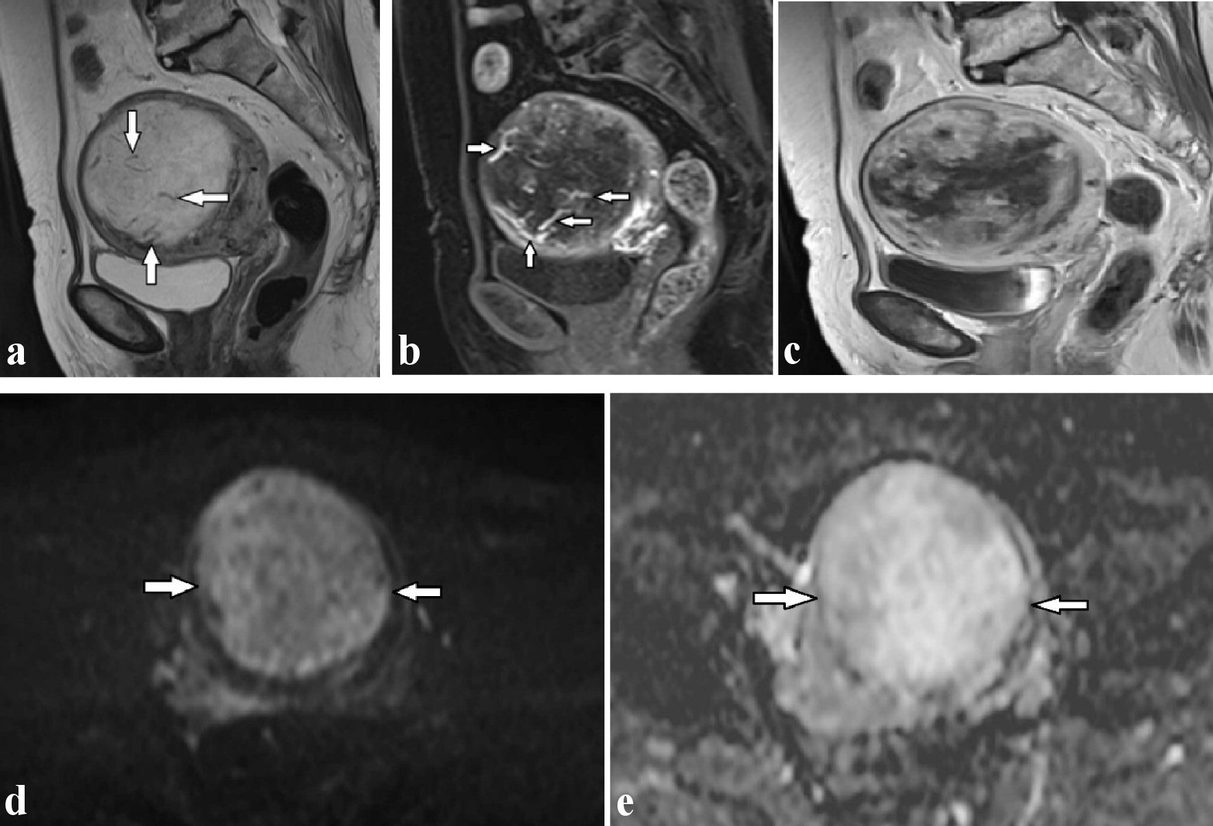 Journal Of Clinical Gynecology And Obstetrics